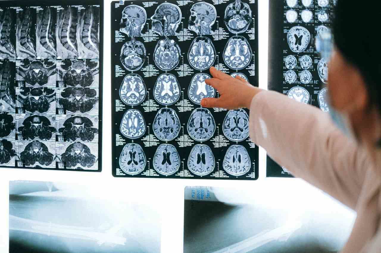 Negatoskop Nedir?