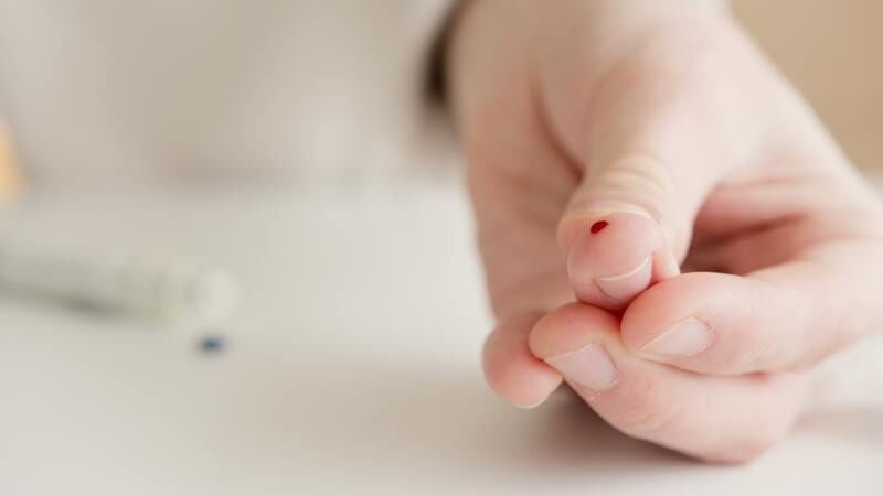 Anti HCV Testi Nedir?